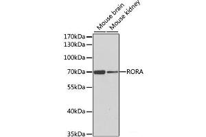 Western blot analysis of extracts of various cell lines using RORA Polyclonal Antibody at dilution of 1:1000. (RORA Antikörper)