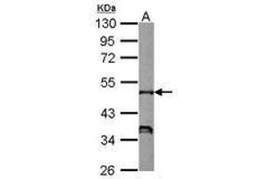 Image no. 1 for anti-Neutrophil Cytosol Factor 1 (NCF1) (AA 1-228) antibody (ABIN1501901) (NCF1 Antikörper  (AA 1-228))