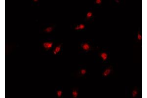 ABIN6269390 staining A-431 cells by IF/ICC.