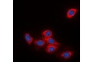 Immunofluorescent analysis of DOK2 staining in HeLa cells. (DOK2 Antikörper)
