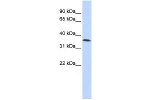 Western Blotting (WB) image for anti-Family with Sequence Similarity 164, Member A (FAM164A) antibody (ABIN2457929) (FAM164A Antikörper)