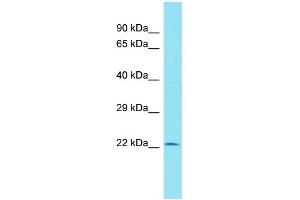 Host: Rabbit Target Name: C11orf40 Sample Type: Hela Whole cell lysates Antibody Dilution: 1. (C11orf40 Antikörper  (N-Term))