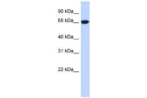 WB Suggested Anti-GTPBP2 Antibody Titration:  0. (GTPBP2 Antikörper  (N-Term))