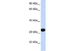 WB Suggested Anti-PDGFB Antibody Titration: 0. (PDGFB Antikörper  (N-Term))