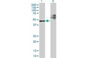 Western Blot analysis of STARD3 expression in transfected 293T cell line by STARD3 monoclonal antibody (M01), clone 1D1.