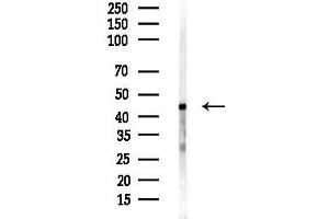 anti-Ureidopropionase, beta (UPB1) antibody