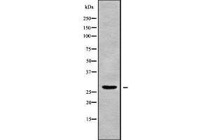 Western blot analysis of C1QL3 using Jurkat whole cell lysates (C1QL3 Antikörper  (Internal Region))