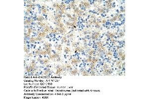 Rabbit Anti-EXOSC6 Antibody  Paraffin Embedded Tissue: Human Liver Cellular Data: Hepatocytes Antibody Concentration: 4. (EXOSC6 Antikörper  (N-Term))