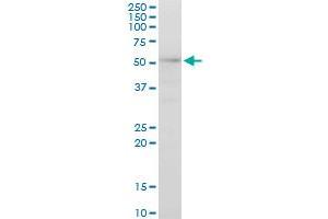 Western Blotting (WB) image for anti-A Kinase (PRKA) Anchor Protein 13 (AKAP13) (AA 1-110) antibody (ABIN524646)