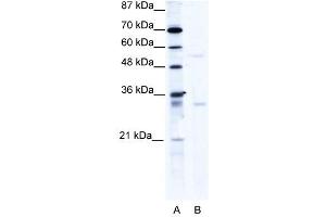 Western Blot showing TRIM17 antibody used at a concentration of 1-2 ug/ml to detect its target protein. (TRIM17 / RNF16 Antikörper  (C-Term))