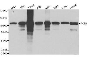 Western blot analysis of extracts of various cell lines using ACTN1 antibody. (ACTN1 Antikörper  (AA 1-330))