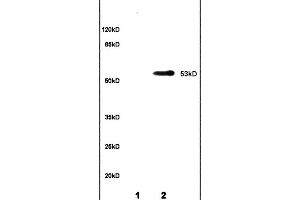 Lane 1: rat brain lysates Lane 2: rat kidney lysates probed with Anti CYP11A1/P450SCC Polyclonal Antibody, Unconjugated (ABIN701530) at 1:200 in 4C. (CYP11A1 Antikörper  (AA 321-420))