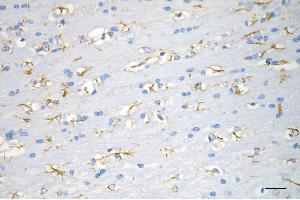 anti-COP9 Signalosome Subunit 8 (COPS8) antibody