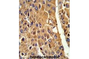Immunohistochemistry (IHC) image for anti-Cytochrome P450, Family 3, Subfamily A, Polypeptide 5 (CYP3A5) antibody (ABIN3003498) (CYP3A5 Antikörper)