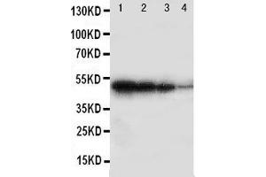 Lane 4: Recombinant Human BMPR1B Protein 1. (BMPR1B Antikörper  (Middle Region))