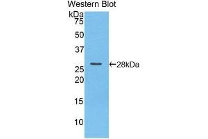 Detection of Recombinant iPLA2, Mouse using Polyclonal Antibody to Phospholipase A2, Calcium Independent (iPLA2) (PNPLA2 Antikörper  (AA 481-702))