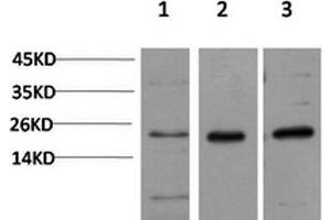 Western Blot analysis of 1) Hela, 2)3T3, 3) PC-12 cells using CBX5 Monoclonal Antibody at dilution of 1:1000. (CBX5 Antikörper)