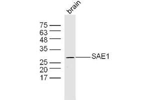 Mouse brain lysates probed with SAE1 Polyclonal Antibody, Unconjugated  at 1:300 dilution and 4˚C overnight incubation. (SAE1 Antikörper  (AA 1-100))
