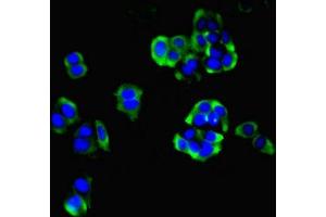 Immunofluorescent analysis of PC-3 cells using ABIN7155229 at dilution of 1:100 and Alexa Fluor 488-congugated AffiniPure Goat Anti-Rabbit IgG(H+L) (HIATL1 Antikörper  (AA 450-506))
