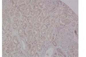 Sample Type:  Human KidneyPrimary   Dilution:  1ug/mL (MSH2 Antikörper  (N-Term))
