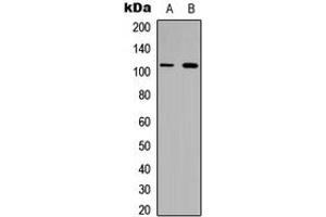 Western blot analysis of Collagen 6 alpha 1 expression in HeLa (A), H9C2 (B) whole cell lysates. (COL6A1 Antikörper  (Center))