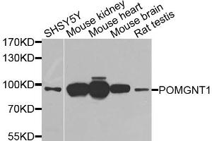 Western blot analysis of extracts of various cell lines, using POMGNT1 antibody. (POMGNT1 Antikörper)