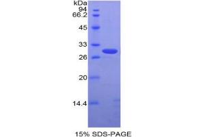 SDS-PAGE analysis of Rabbit ALCAM Protein. (CD166 Protein)
