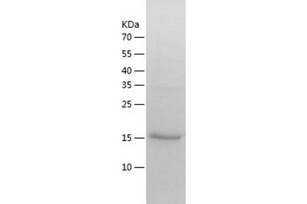 ADI1 Protein (AA 1-179) (His tag)