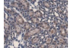 Immunohistochemistry (IHC) image for anti-Lipopolysaccharides (LPS) antibody (ABIN7426676)