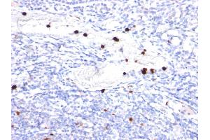 Formalin-fixed, paraffin-embedded human Tonsil stained with Cystatin A Mouse Monoclonal Antibody (CPTC-CSTA-1). (CSTA Antikörper)