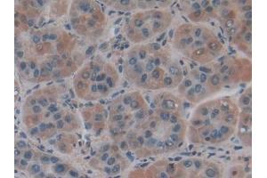 Immunohistochemistry (IHC) image for anti-Collagen, Type IV, alpha 1 (COL4A1) (AA 1444-1669) antibody (ABIN7431209)