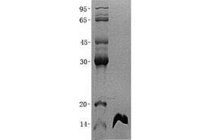 Western Blotting (WB) image for Fatty Acid Binding Protein 6, Ileal (FABP6) (Transcript Variant 1) protein (His tag) (ABIN2720671)