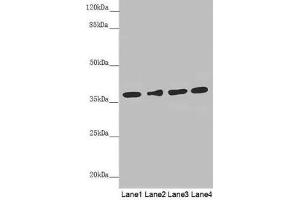 Western blot All lanes: ERLIN2 antibody at 3. (ERLIN2 Antikörper  (AA 212-339))