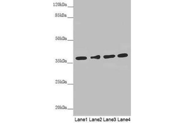 ERLIN2 anticorps  (AA 212-339)