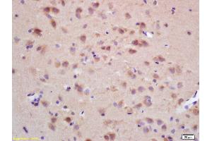 Formalin-fixed and paraffin embedded rat brain labeled with Rabbit Anti CHRNB2 Polyclonal Antibody, Unconjugated (ABIN705836) at 1:200 followed by conjugation to the secondary antibody and DAB staining (CHRNB1 Antikörper  (AA 131-230))
