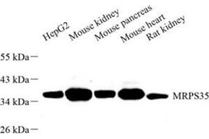 Western blot analysis of MRPS35 (ABIN7074655) at dilution of 1: 500