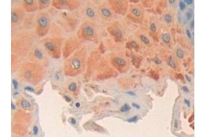 Detection of CCND2 in Human Esophagus Tissue using Polyclonal Antibody to Cyclin D2 (CCND2) (Cyclin D2 Antikörper  (AA 68-278))