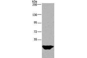 Western Blot analysis of Human testis tissue using MTF2 Polyclonal Antibody at dilution of 1:400 (MTF2 Antikörper)