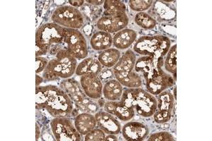Immunohistochemical staining of human kidney with C6orf108 polyclonal antibody  shows strong cytoplasmic positivity in tubular cells.