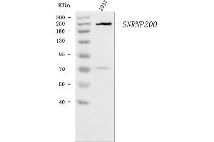 Western blot analysis of SNRNP200 using anti-SNRNP200 antibody (ABIN7602032). (SNRNP200 Antikörper  (AA 557-2129))
