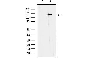 anti-Trichorhinophalangeal Syndrome I (TRPS1) (N-Term) antibody