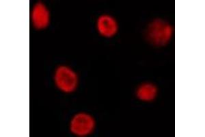 ABIN6276841 staining HepG2 by IF/ICC. (MED1 Antikörper  (Internal Region))