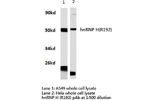 Western blot (WB) analysis of hnRNP H antibody in extracts from hela and A549 cells. (HNRNPH1 Antikörper)