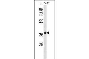 Western blot analysis in Jurkat cell line lysates (35ug/lane). (HSPBP1 Antikörper  (N-Term))