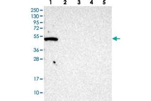 Western blot analysis of Lane 1: RT-4, Lane 2: U-251 MG, Lane 3: human plasma, Lane 4: liver, Lane 5: tonsil GTPBP10 polyclonal antibody . (GTPBP10 Antikörper)