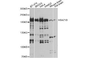 Western blot analysis of extracts of various cell lines, using BAZ1B antibody (ABIN6290092) at 1:1000 dilution. (BAZ1B Antikörper)