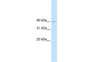 Western Blotting (WB) image for anti-Nudix (Nucleoside Diphosphate Linked Moiety X)-Type Motif 9 (NUDT9) antibody (ABIN2461168) (NUDT9 Antikörper)