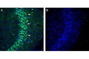 Expression of NHE7 in mouse hippocampus. (Sodium Hydrogen Exchanger 7 (SLC9A7) Peptid)