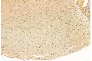 ABIN6265362 and ABIN6272951 at 1/100 staining Rat brain tissue by IHC-P. (SUCLA2 Antikörper  (Internal Region))