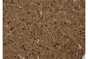 ABIN6277781 at 1/100 staining Rat brain tissue by IHC-P. (Arrestin 3 Antikörper  (C-Term))